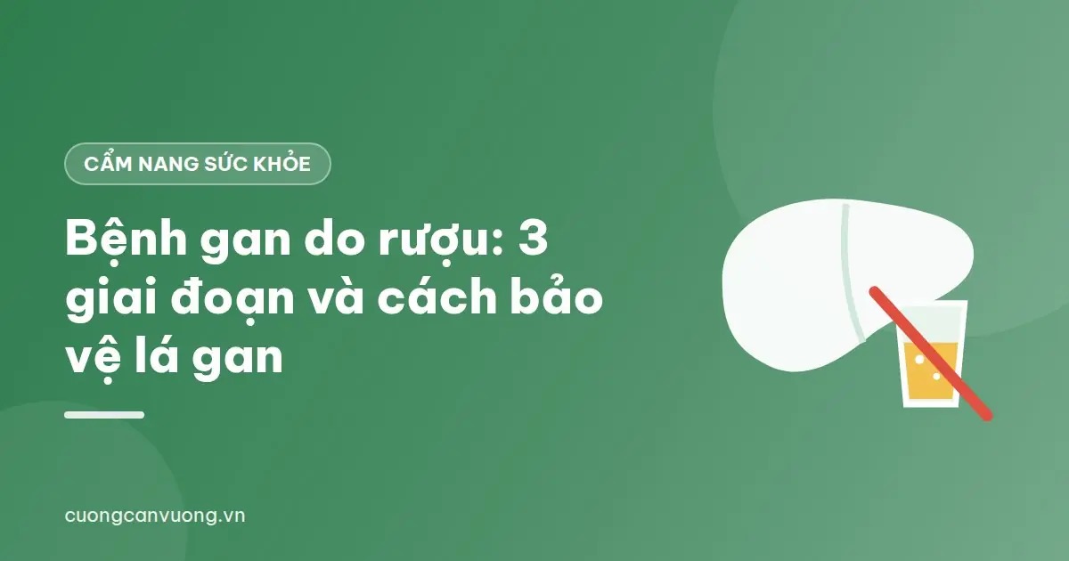 Ảnh đồ họa nền xanh lá: hình lá gan cạnh ly bia bị gạch chéo màu đỏ, kèm tiêu đề bài viết
